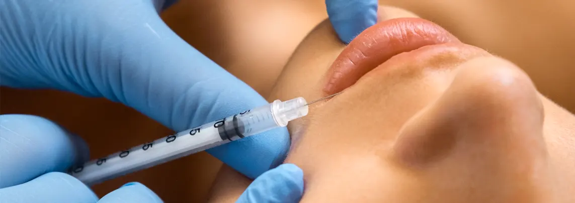 Fillers acido hialuronico - Belle & Health